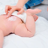 Crema Antipañalitis cerca a Real de Minas